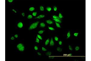 Immunofluorescence (IF) image for anti-Polymerase (DNA Directed) kappa (POLK) (AA 1-472) antibody (ABIN565606)