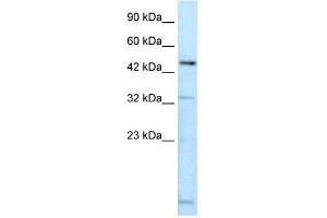 WB Suggested Anti-DMRTA2 Antibody Titration: 0. (DMRTA2 Antikörper  (C-Term))