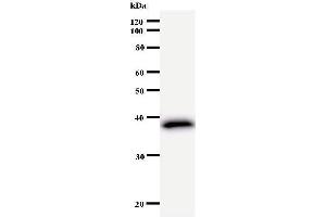 Western Blotting (WB) image for anti-FER Tyrosine Kinase (FER) antibody (ABIN933005) (FER Antikörper)
