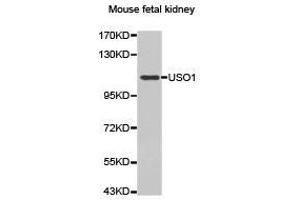 Western Blotting (WB) image for anti-USO1 Homolog, Vesicle Docking Protein (USO1) antibody (ABIN1875291) (USO1 Antikörper)