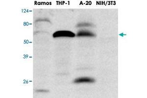 Western blot analysis of extracts of Ramos , THP - 1 , A20 and NIH/3T3 were resolved by SDS - PAGE , transferred to PVDF membrane and probed with IRF5 monoclonal antibody , clone 10T1 (1 : 1000)  . (IRF5 Antikörper  (AA 176-240))