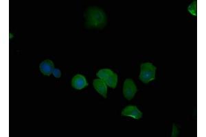 Immunofluorescence staining of MCF-7 cells with ABIN7139704 at 1:50, counter-stained with DAPI. (PSMD6 Antikörper  (Regulatory Subunit 6))