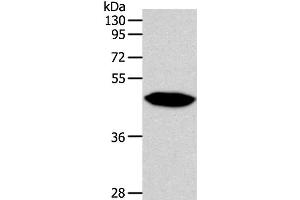 Western Blot analysis of Human fetal brain tissue using NPY1R Polyclonal Antibody at dilution of 1:500 (NPY1R Antikörper)