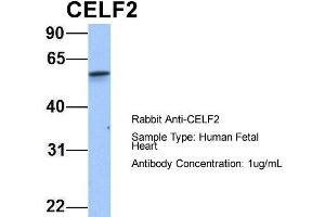 Host: Rabbit Target Name: CELF2 Sample Type: Human Fetal Heart Antibody Dilution: 1.