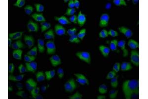 Immunofluorescence staining of Hela cells with ABIN7152666 at 1:133, counter-stained with DAPI. (FCRL5 Antikörper  (AA 419-553))