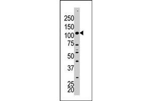The HK2 polyclonal antibody  is used in Western blot to detect HK2 in A-375 cell lysate. (Hexokinase 2 Antikörper  (Internal Region))