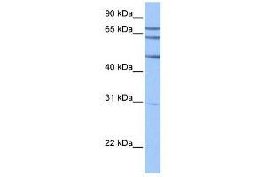 TSKS antibody used at 1 ug/ml to detect target protein.