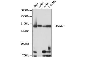 Western blot analysis of extracts of various cell lines, using SFSWAP antibody (ABIN7270551) at 1:1000 dilution. (SFRS8 Antikörper  (AA 170-280))