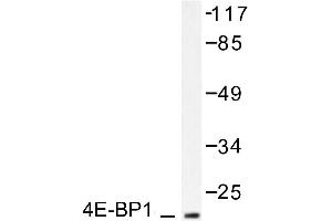 Image no. 2 for anti-Eukaryotic Translation Initiation Factor 4E Binding Protein 1 (EIF4EBP1) antibody (ABIN271863) (eIF4EBP1 Antikörper)