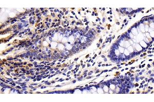 Immunohistochemistry (IHC) image for anti-Caspase 8 (CASP8) (AA 7-201) antibody (ABIN7444115)