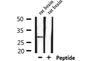 Western blot analysis of extracts from rat brain, using OR6C75 Antibody. (OR6C75 Antikörper)