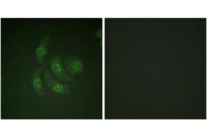 Immunofluorescence analysis of HepG2 cells, using CaMK4 (Ab-196/200) Antibody. (CAMK4 Antikörper  (AA 166-215))
