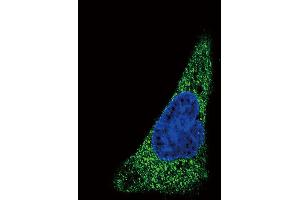 Confocal immunofluorescent analysis of SLC11A2 Antibody with HepG2 cell followed by Alexa Fluor 488-conjugated goat anti-rabbit lgG (green).