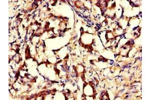 Immunohistochemistry (IHC) image for anti-Glucosamine-Phosphate N-Acetyltransferase 1 (GNPNAT1) (AA 1-184) antibody (ABIN7153896)