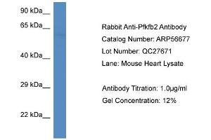 Western Blotting (WB) image for anti-6-phosphofructo-2-Kinase/fructose-2,6-Biphosphatase 2 (PFKFB2) (C-Term) antibody (ABIN2786833) (PFKFB2 Antikörper  (C-Term))