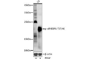 Western blot analysis of extracts of C6 cells, using Phospho-eIF4EBP1-T37/46 antibody (ABIN3019469, ABIN3019470, ABIN3019471 and ABIN6225387) at 1:1000 dilution. (eIF4EBP1 Antikörper  (pThr37, pThr46))