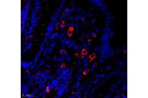 Immunofluorescence of paraffin embedded mouse appendix using MS4A2 (ABIN7074594) at dilution of 1: 400 (550x lens) (MS4A2 Antikörper)