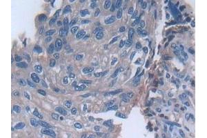 Immunohistochemistry (IHC) image for anti-Matrix Metallopeptidase 23B (MMP23B) (AA 79-390) antibody (ABIN7431308)