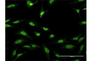 Immunofluorescence of purified MaxPab antibody to CUGBP1 on HeLa cell.