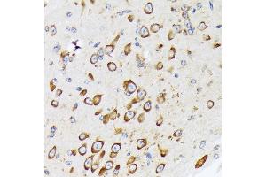 Immunohistochemistry of paraffin-embedded mouse brain using RPS20 Rabbit mAb (ABIN7270017) at dilution of 1:100 (40x lens). (RPS20 Antikörper)