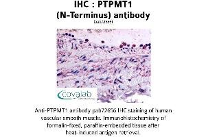 Image no. 1 for anti-Protein Tyrosine Phosphatase, Mitochondrial 1 (PTPMT1) (N-Term) antibody (ABIN1738592) (PTPMT1 Antikörper  (N-Term))