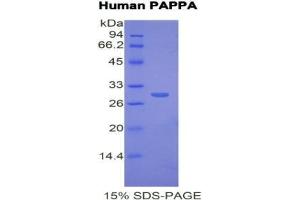 SDS-PAGE analysis of Human PAPPA Protein. (PAPPA Protein)