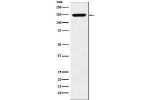 Western blot analysis of p150 CAF1 expression in K562 cell lysate. (Rekombinanter CHAF1A Antikörper)