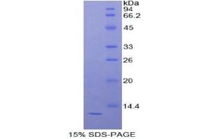 SDS-PAGE analysis of Mouse DBI Protein.
