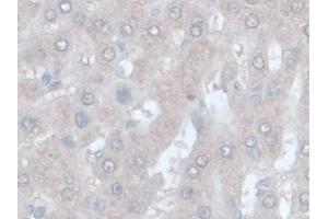 IHC-P analysis of Rat Liver Tissue, with DAB staining. (ORM1 Antikörper  (AA 19-186))