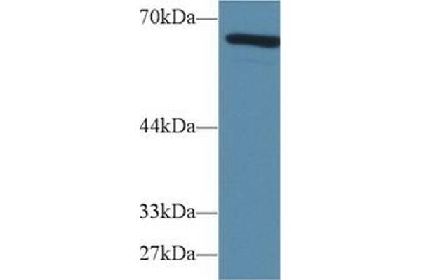 alpha Fetoprotein Antikörper  (AA 399-605)