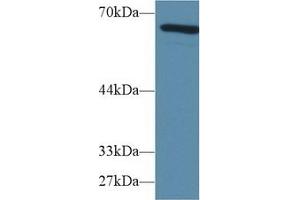 Detection of AFP in Mouse Lung lysate using Polyclonal Antibody to Alpha-Fetoprotein (AFP) (alpha Fetoprotein Antikörper  (AA 399-605))