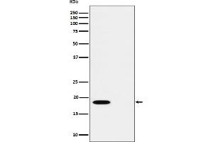 Western blot analysis of Phospho-PTS (S19) expression in (1) HUVEC cell lysate, (2) HUVEC cell treated with Alkaline Phosphatase lysate.