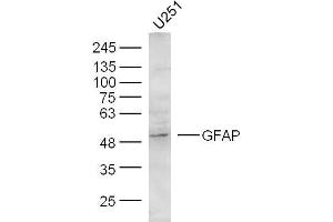 U251 Cells lysates probed with GFAP Polyclonal Antibody, unconjugated  at 1:300 overnight at 4°C followed by a conjugated secondary antibody at 1:10000 for 60 minutes at 37°C. (GFAP Antikörper  (AA 51-150))