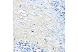 Immunohistochemistry of paraffin-embedded human esophageal using CCR7 Rabbit mAb (ABIN7266309) at dilution of 1:100 (40x lens). (CCR7 Antikörper)