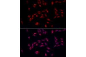 Immunofluorescence (IF) image for anti-FACT complex subunit SPT16 (SUPT16H) antibody (ABIN7267097)