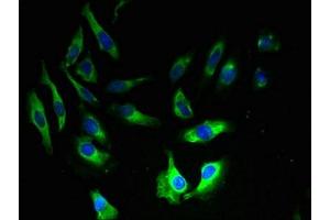 Immunofluorescence (IF) image for anti-Adaptor-Related Protein Complex 2, sigma 1 Subunit (AP2S1) (AA 1-142) antibody (ABIN7144373)