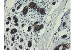 Immunohistochemical staining of paraffin-embedded Human breast tissue using anti-DPH2 mouse monoclonal antibody. (DPH2 Antikörper)