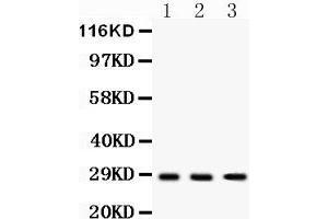 Western Blotting (WB) image for anti-Dickkopf 2 Homolog (DKK2) (AA 34-259) antibody (ABIN3043565) (DKK2 Antikörper  (AA 34-259))
