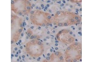 Used in DAB staining on fromalin fixed paraffin- embedded kidney tissue (TMOD3 Antikörper  (AA 1-352))