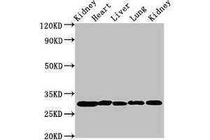 Western Blot Positive WB detected in: Rat kidney tissue, Rat heart tissue, Rat liver tissue, Mouse lung tissue, Mouse kidney tissue All lanes: CA2 antibody at 2 μg/mL Secondary Goat polyclonal to rabbit IgG at 1/50000 dilution Predicted band size: 30 kDa Observed band size: 30 kDa