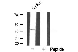 Western blot analysis of Annexin III Antibody expression in rat liver tissue lysates. (Annexin A3 Antikörper  (N-Term))