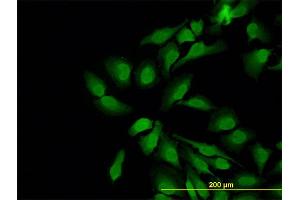 Immunofluorescence of monoclonal antibody to WASL on HeLa cell. (Neural Wiskott-Aldrich syndrome protein (WASL) (AA 97-184) Antikörper)