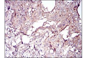 Immunohistochemistry (IHC) image for anti-Villin 1 (VIL1) (AA 1-209) antibody (ABIN5542404)