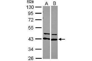 WB Image Sample (30 ug of whole cell lysate) A: 293T B: Raji 10% SDS PAGE antibody diluted at 1:10000 (HNRNPD/AUF1 Antikörper)