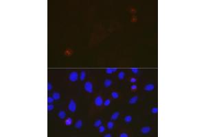 Immunofluorescence analysis of C6 cells using T Rabbit mAb (ABIN7270916) at dilution of 1:100 (40x lens). (TACC3 Antikörper)