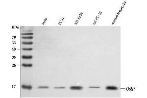 Western blot analysis of OMP using anti-OMP antibody (ABIN7601711).
