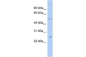 TTC8 antibody used at 1 ug/ml to detect target protein. (TTC8 Antikörper  (N-Term))
