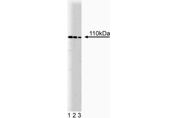 NEDD4 Antikörper  (AA 173-262)