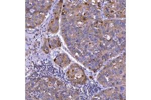 anti-Septin 11 (SEPT11) (C-Term) antibody