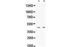 Western blot analysis of APOBEC3G expression in A431 whole cell lysates ( Lane 1), and JURKAT whole cell lysates ( Lane 2).